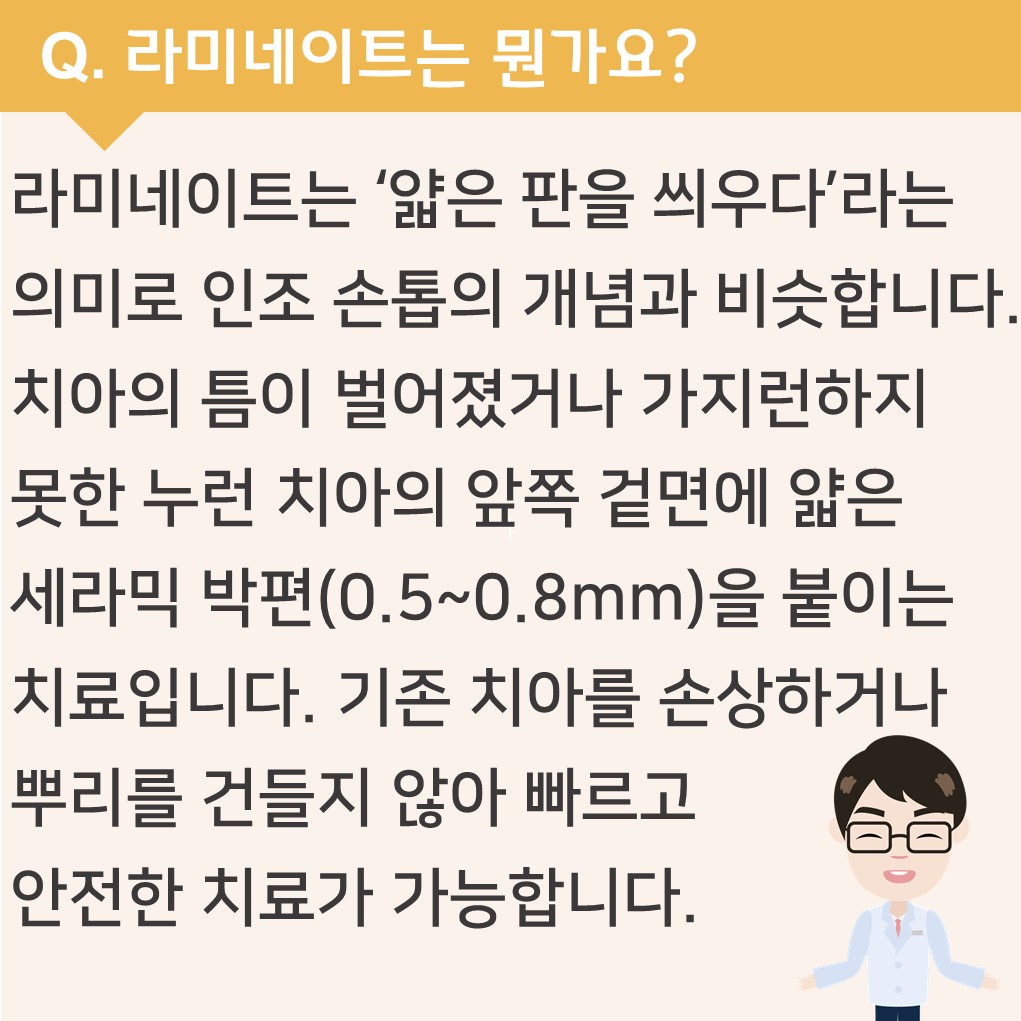 라미네이트는 뭔가요?