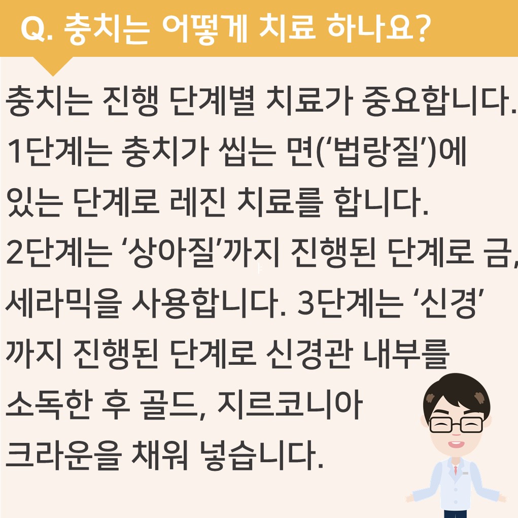 충치는 어떻게 치료하나요?