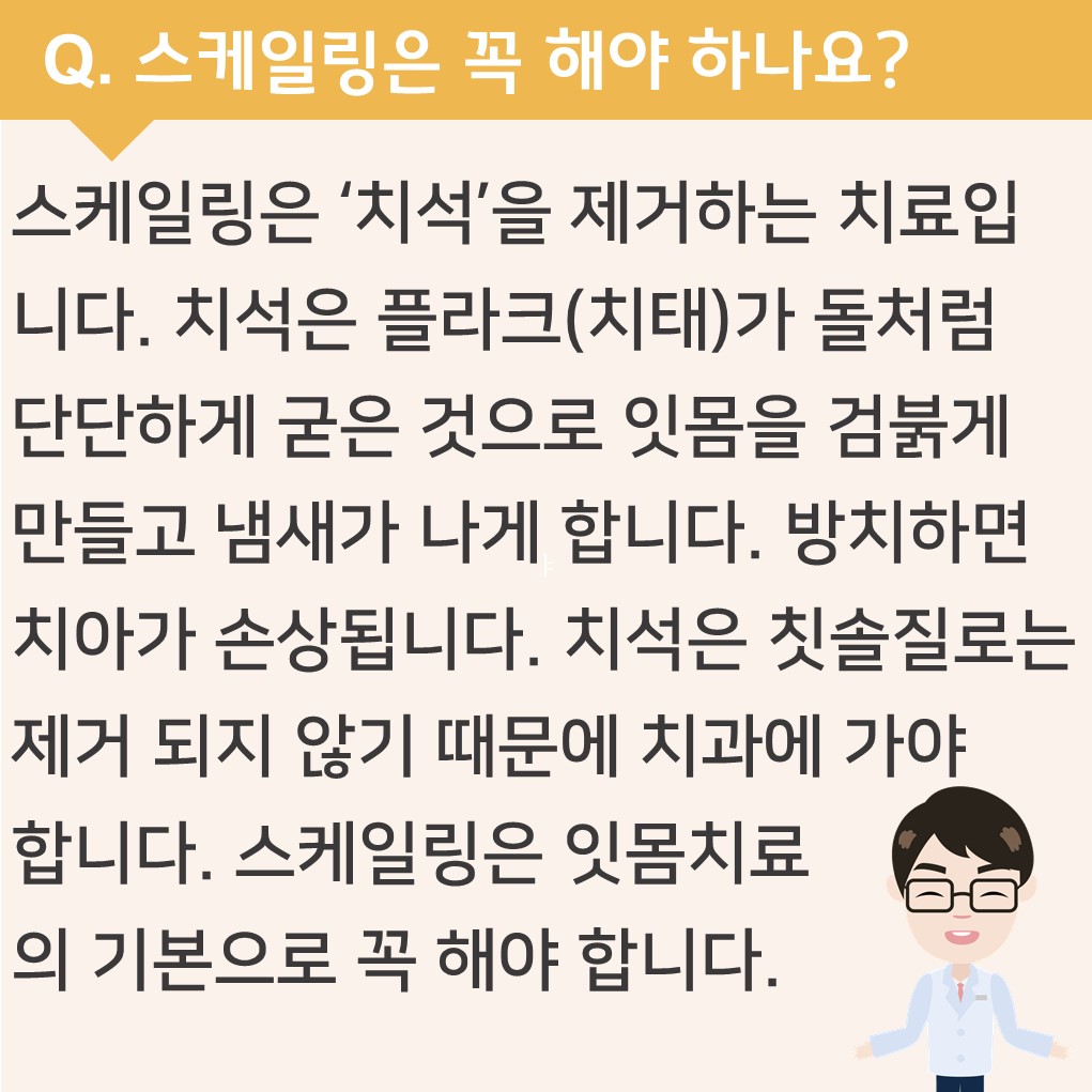 스케일링은 꼭 해야 하나요?