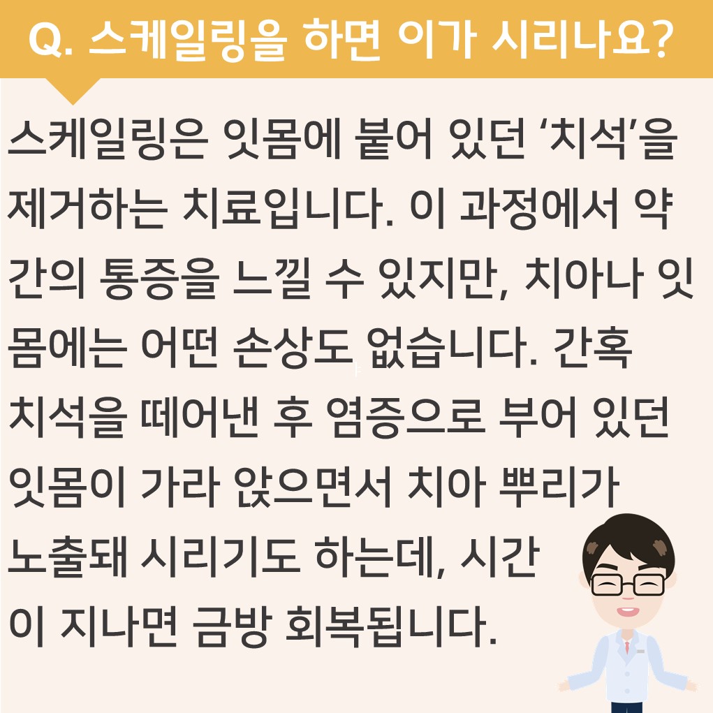 스케일링하면 이가 시리나요?